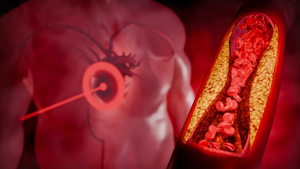 Alimento barato pode reduzir o colesterol em até 4 semanas, diz estudo