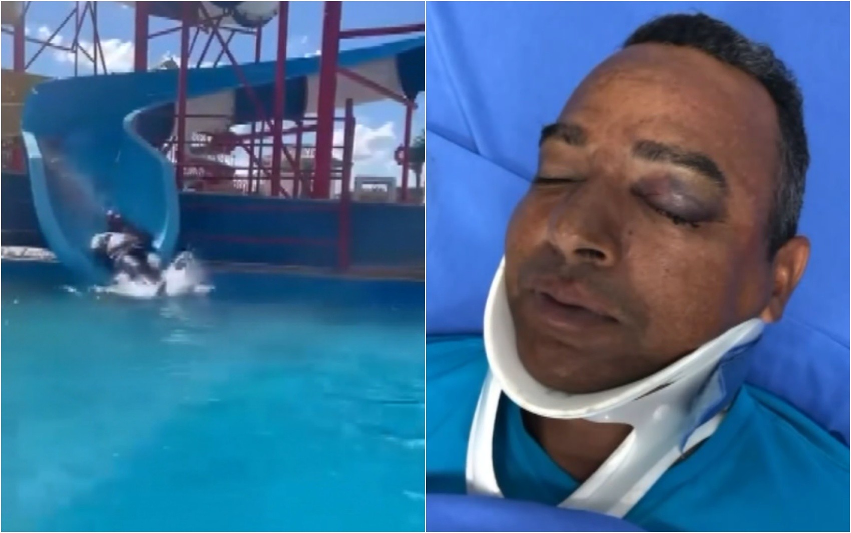 Homem é internado após acidente em toboágua em MG; família aponta falta de monitoramento e omissão de socorro