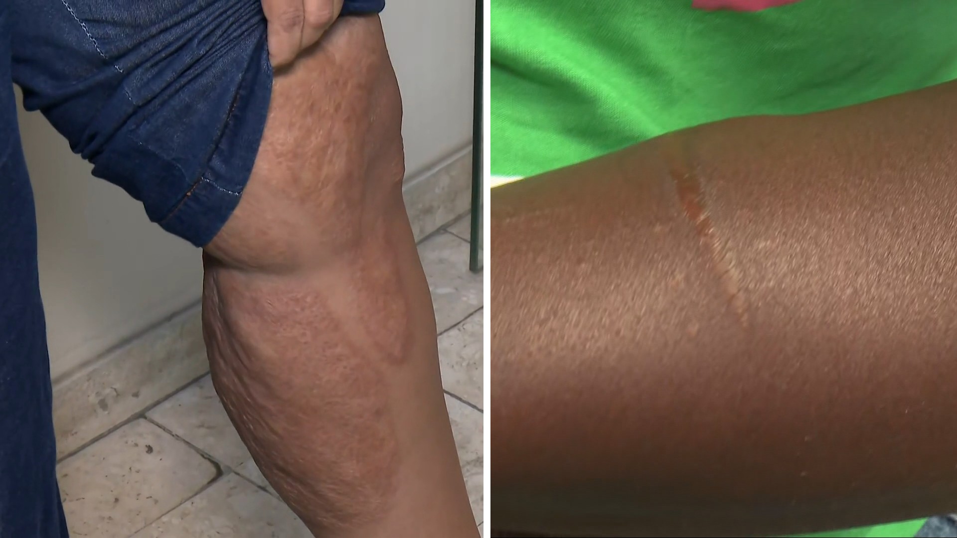 Conheça o projeto que oferece cirurgias plásticas gratuitas a mulheres vítimas de violência doméstica